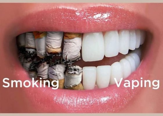 Hút vape có vàng răng không?